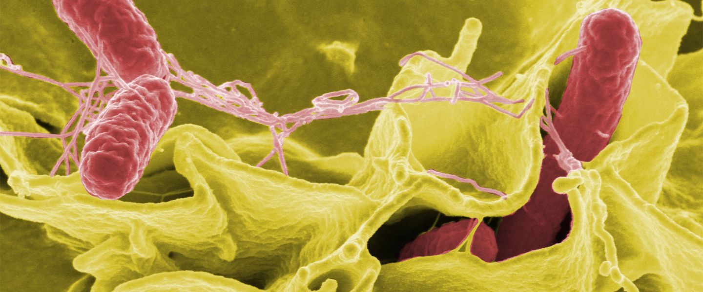 bacterie vue d'un mucroscope - salmonelle - maladie rats